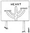 Heart bypass Heart bypass
